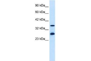 WB Suggested Anti-M96 Antibody Titration:  0. (MTF2 抗体  (Middle Region))