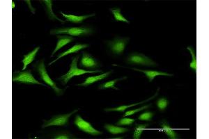 Immunofluorescence of purified MaxPab antibody to DNMT3L on HeLa cell. (DNMT3L 抗体  (AA 1-386))