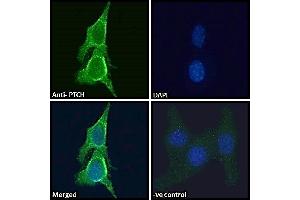 Immunofluorescence (IF) image for anti-Patched 1 (PTCH1) (C-Term) antibody (ABIN185521)