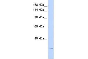 WB Suggested Anti-KCNK6 Antibody Titration:  0. (KCNK6 抗体  (N-Term))