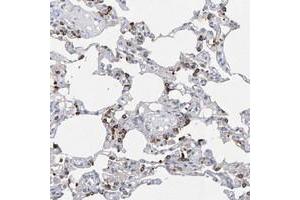 Immunohistochemical staining of human lung with ZNF77 polyclonal antibody  shows strong cytoplasmic positivity in subsets of alveolar cells. (ZNF77 抗体)