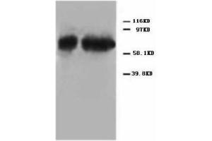 Image no. 2 for anti-Tumor Protein P73 (TP73) (C-Term) antibody (ABIN1492940)