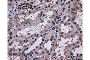 Immunohistochemical staining of paraffin-embedded thyroid tissue using anti-L1CAMmouse monoclonal antibody. (L1CAM 抗体)
