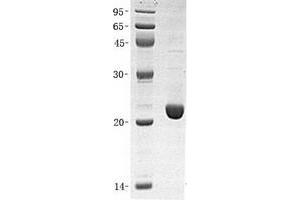 Western Blotting (WB) image for Proteasome (Prosome, Macropain) 26S Subunit, Non-ATPase, 10 (PSMD10) (Transcript Variant 1) protein (ABIN2729975)