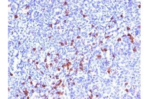 Formalin-fixed, paraffin-embedded human Tonsil stained with IgG Monoclonal Antibody (SPM556) (IGHG 抗体)