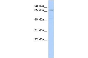 WB Suggested Anti-CLPB Antibody Titration: 0. (CLPB 抗体  (Middle Region))