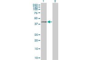 Western Blot analysis of ST3GAL1 expression in transfected 293T cell line by ST3GAL1 MaxPab polyclonal antibody. (ST3GAL1 抗体  (AA 1-340))