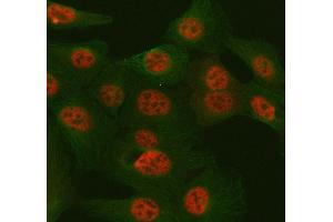 IF analysis of TULP3 using anti-TULP3 antibody (ABIN7602191) and anti-Tubulin Alpha antibody (ABIN7600339). (TULP3 抗体  (AA 62-362))