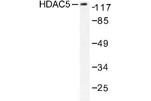 Image no. 2 for anti-Histone Deacetylase 5 (HDAC5) antibody (ABIN265457) (HDAC5 抗体)
