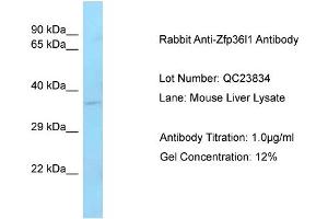 Host: Rabbit Target Name: Zfp36I1 Sample Type: Mouse Liver Antibody Dilution: 1. (ZFP36L1 抗体  (C-Term))