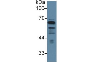 Detection of LCAT in Human PC3 cell lysate using Polyclonal Antibody to Lecithin Cholesterol Acyltransferase (LCAT) (LCAT 抗体  (AA 290-432))