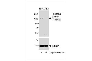 Western blot analysis of lysates from NIH/3T3 cell line, untreated or treated with λ phosphatases, 30 min, using Phospho-MYPT1 (Thr852) Antibody (upper) or Tubulin (lower). (PPP1R12A 抗体  (pThr852))