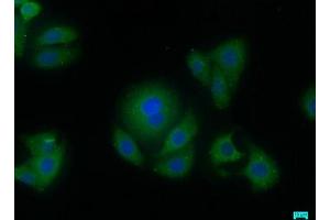 Immunofluorescence staining of HepG2 cells with ABIN7144476 at 1:50, counter-stained with DAPI. (AIFM2 抗体  (AA 110-373))