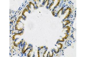 Immunohistochemistry of paraffin-embedded Rat lung using AK1 Polyclonal Antibody at dilution of 1:100 (40x lens). (Adenylate Kinase 1 抗体)