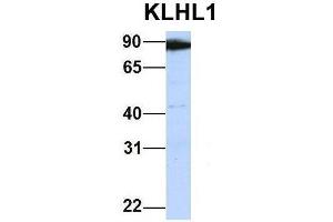 Host:  Rabbit  Target Name:  KLHL1  Sample Type:  Human 721_B  Antibody Dilution:  1. (KLHL1 抗体  (Middle Region))