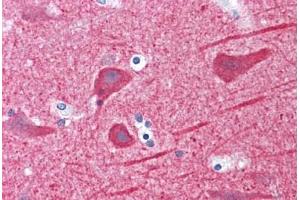 Human Brain, cortex: Formalin-Fixed, Paraffin-Embedded (FFPE) (TUBB2B 抗体  (AA 1-445))