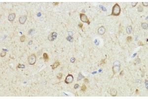 Immunohistochemistry of paraffin-embedded Rat brain using HACE1 Polyclonal Antibody at dilution of 1:100 (40x lens).