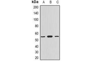 Western blot analysis of Myotilin expression in HepG2 (A), mouse heart (B), rat heart (C) whole cell lysates. (Myotilin 抗体)