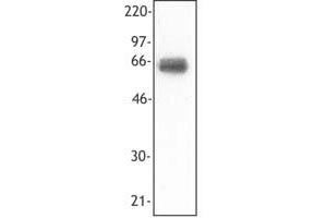Image no. 1 for anti-Triggering Receptor Expressed On Myeloid Cells 1 (TREM1) antibody (ABIN205339) (TREM1 抗体)