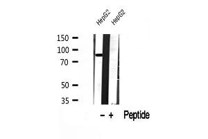 Western blot analysis of extracts of HepG2 cells, using DDX21 antibody.