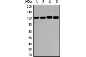 Western blot analysis of GLUR3 expression in U251 (A), PC3 (B), mouse brain (C), mouse lung (D) whole cell lysates. (Glutamate Receptor 3 抗体)