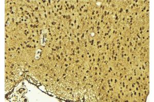 ABIN6275645 at 1/100 staining Mouse brain tissue by IHC-P. (TSEN54 抗体  (Internal Region))