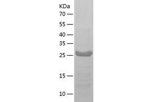 Western Blotting (WB) image for TatD DNase Domain Containing 3 (TATDN3) (AA 1-274) protein (His tag) (ABIN7125321)