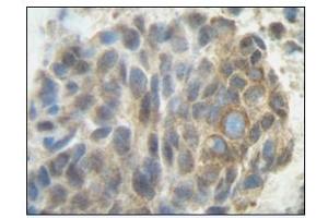 Image no. 1 for anti-Placenta Growth Factor (PGF) antibody (ABIN181639) (PLGF 抗体)