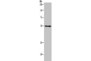 Western Blotting (WB) image for anti-IMP (Inosine 5'-Monophosphate) Dehydrogenase 2 (IMPDH2) antibody (ABIN2423659) (IMPDH2 抗体)
