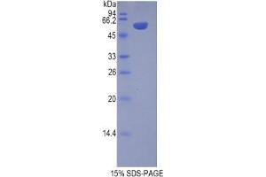 SDS-PAGE analysis of Pig Chromogranin B Protein. (CHGB 蛋白)