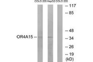 Western blot analysis of extracts from COLO/HepG2 cells, using OR4A15 Antibody. (OR4A15 抗体  (AA 261-310))