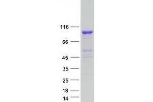 Validation with Western Blot