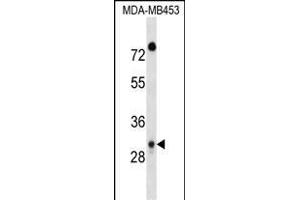 DP1 Antibody (C-term) 17383b western blot analysis in MDA-M cell line lysates (35 μg/lane). (DAPP1 抗体  (C-Term))