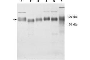 Western blot analysis of Scarb2 in various samples using Scarb2 polyclonal antibody . (SCARB2 抗体)