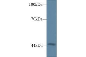 Detection of TRDN in Mouse Heart lysate using Polyclonal Antibody to Triadin (TRDN) (Triadin 抗体  (AA 486-687))