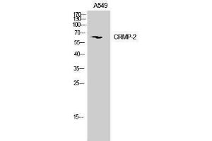 Western Blotting (WB) image for anti-Dihydropyrimidinase-Like 2 (DPYSL2) (Ser306), (Ser309) antibody (ABIN3179981) (DPYSL2 抗体  (Ser306, Ser309))