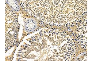 ABIN6257331 and ABIN6275242 at 1/100 staining rat testis tissue by IHC-P. (MRPL3 抗体  (N-Term))