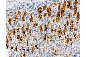 ABIN6262087 and ABIN6278064 at 1/100 staining Rat stomach tissue by IHC-P.