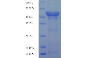 FBXL18 Protein (AA 1-365, Isoform 3) (His-SUMO Tag)