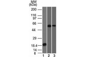 Western blot analysis of 1) partial recombinant protein, 2) A549 and 3) A431 stained with TOX-3 antibody (TOX3/1124). (TOX3 抗体  (AA 200-400))