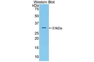 Western blot analysis of the recombinant protein. (TAB1 抗体  (AA 189-439))