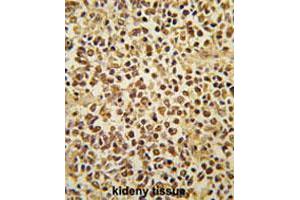 Formalin-fixed and paraffin-embedded human kidney tissue reacted with SNAI1 polyclonal antibody  , which was peroxidase-conjugated to the secondary antibody, followed by AEC staining. (SNAIL 抗体  (AA 9-39))