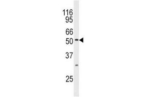 Western blot analysis of JNK3 antibody and mouse brain tissue lysate. (MAPK10 抗体  (AA 1-30))