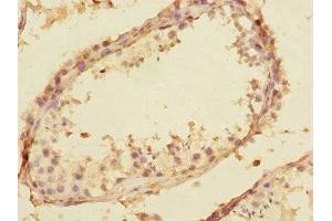 Immunohistochemistry of paraffin-embedded human testis tissue using ABIN7170630 at dilution of 1:100 (Splicing factor U2AF 26 kDa subunit (U2AF1L4) (AA 1-202) 抗体)