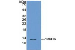 Detection of Recombinant S100A4, Human using Polyclonal Antibody to S100 Calcium Binding Protein A4 (S100A4) (s100a4 抗体  (AA 2-101))