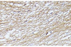 Immunohistochemistry of paraffin-embedded Rat brain using SEPT5 Polyclonal Antibody at dilution of 1:100 (40x lens). (Septin 5 抗体)