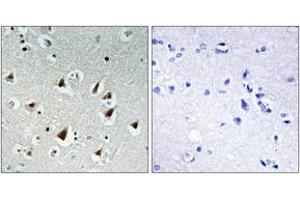 Immunohistochemistry analysis of paraffin-embedded human brain tissue, using ZHX2 Antibody.