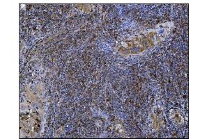 IHC analysis of POGLUT1 using anti-POGLUT1 antibody (ABIN7602910). (POGLUT1 抗体  (C-Term))