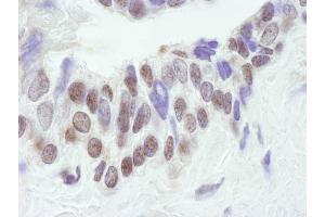 Immunohistochemistry (IHC) image for anti-CREB Binding Protein (CREBBP) (AA 2375-2425) antibody (ABIN7448459)