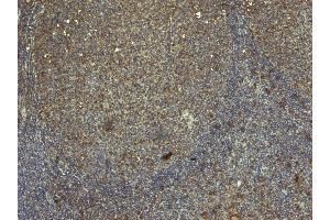 (ABIN185256) (3 μg/mL) staining of paraffin embedded Human Tonsil. (RAN 抗体  (N-Term))